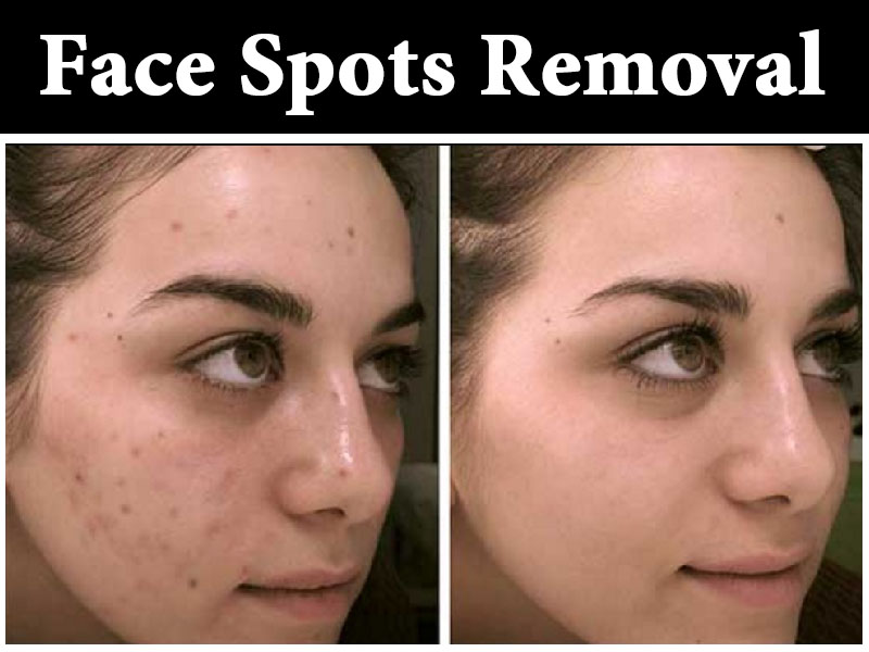skin-treatment2