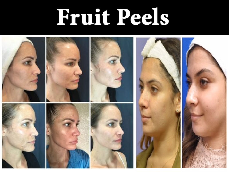 skin-treatment4