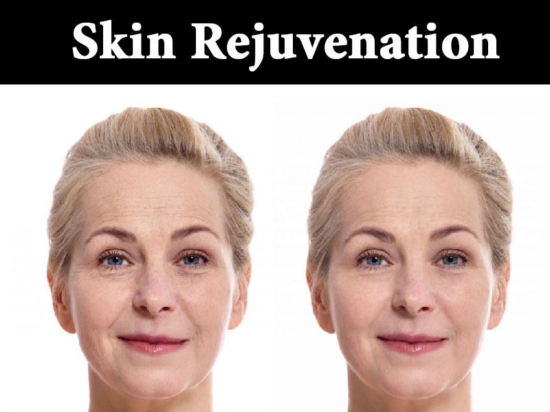 skin-treatment8